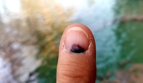 finger nail