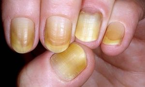 finger nails