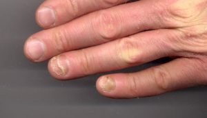 Finger nails